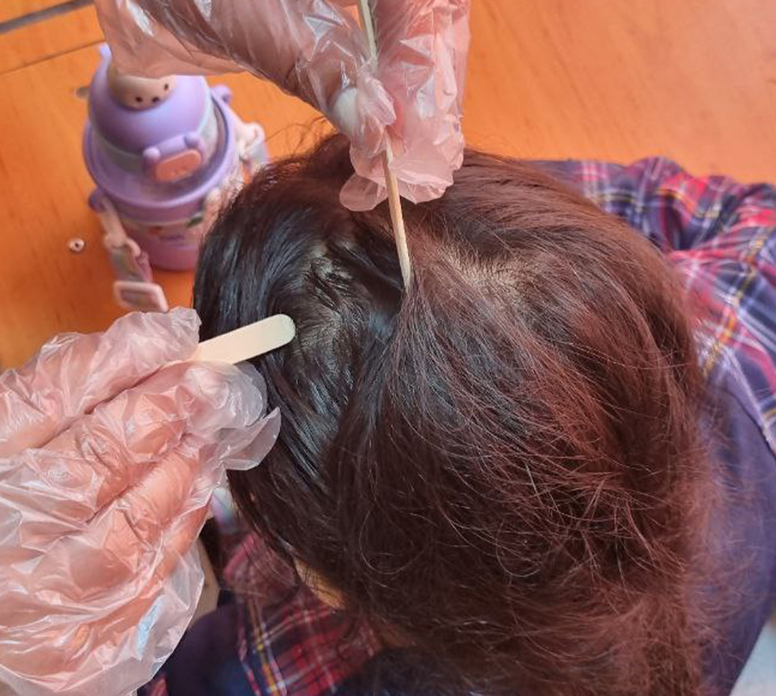 معاینات پدیکلوزیس